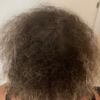 Après le traitement — cas 34